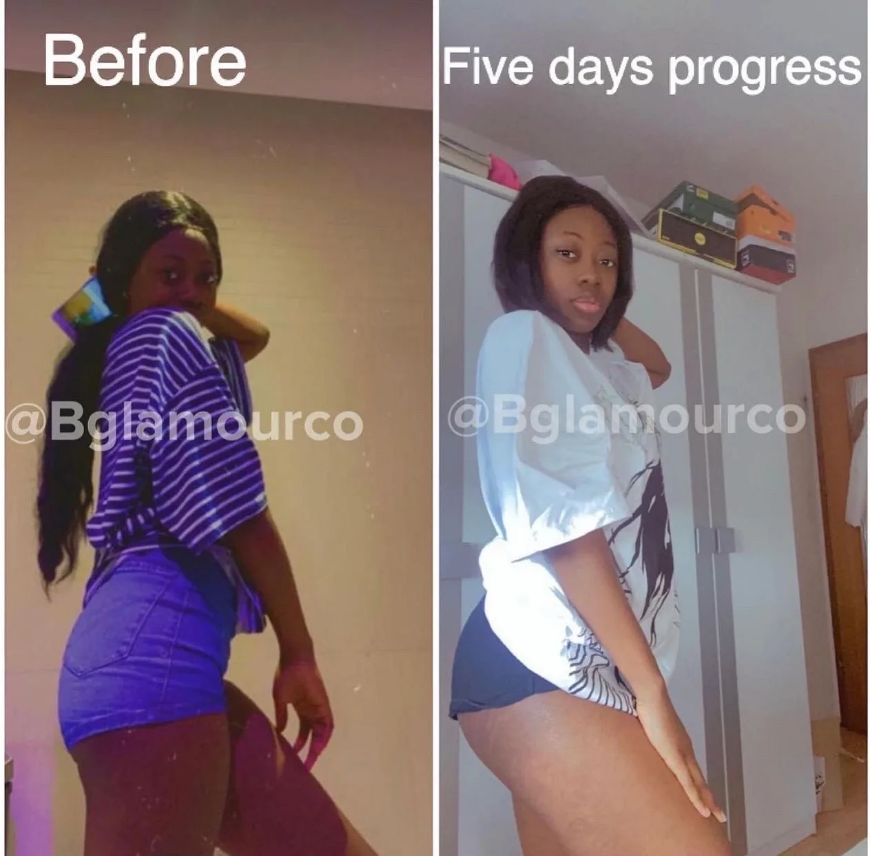 Natural BUM Hips Thighs Enlargement Powder Bigger Butt Enhancement BBL Uplift Shaping Supplement Fast Effect