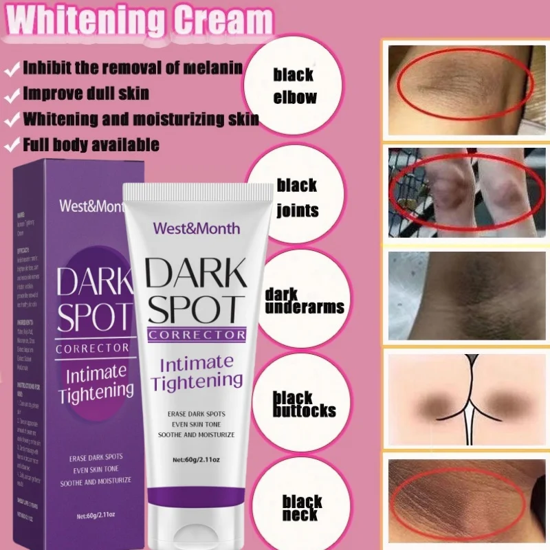 Nicotinamide Brightening Cream For Dark Skin Effective Lighten Thigh Inner Bleach Remove Melanin Private Parts Brighten Cream