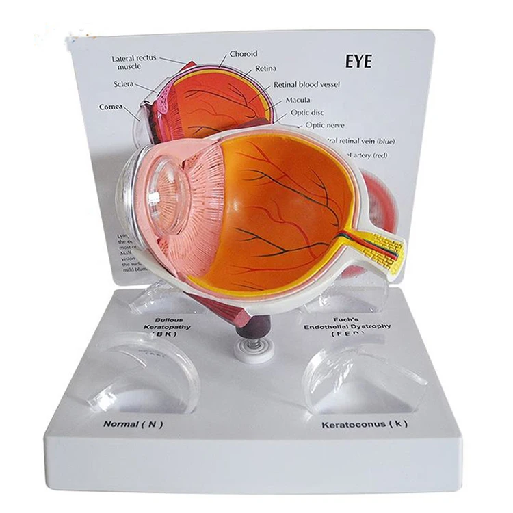 

Анатомия катаракта человеческого глазного яблока Медицинская наука Анатомическая модель человеческого глаза