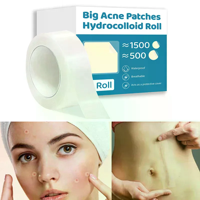 1Pcs Hydrocolloid Roll For Wound Care Hydrocolloid Patch Bandages With Self-Adhesive, Bed Sore Bandages, Highly Absorbent