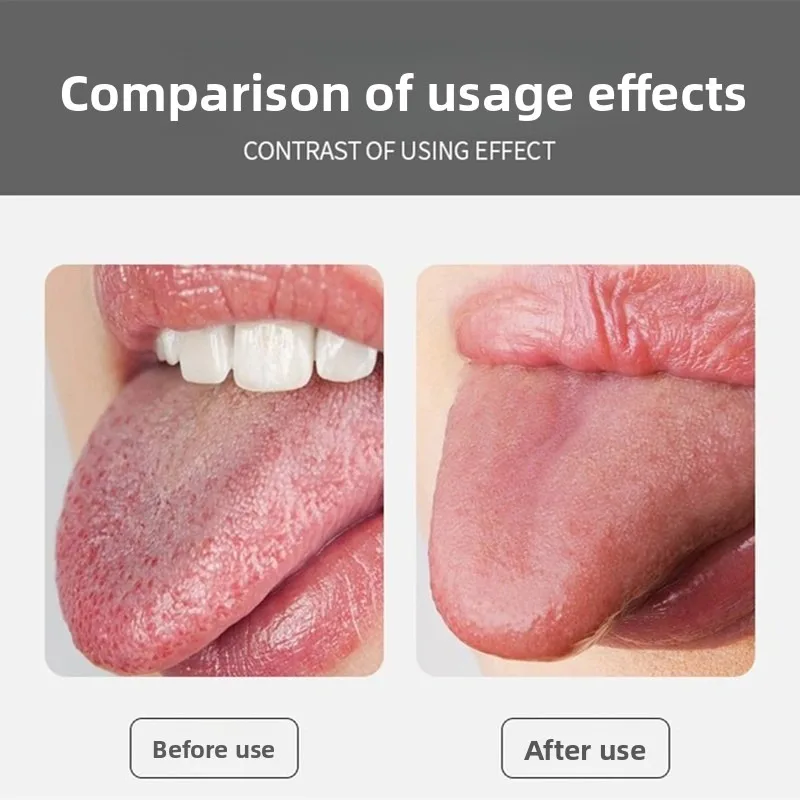 Daily Oral Care Tongue Scraper,Remove Tongue Plaque & Coating, Fresh Breath Treatment, High Quality Anti-Rust