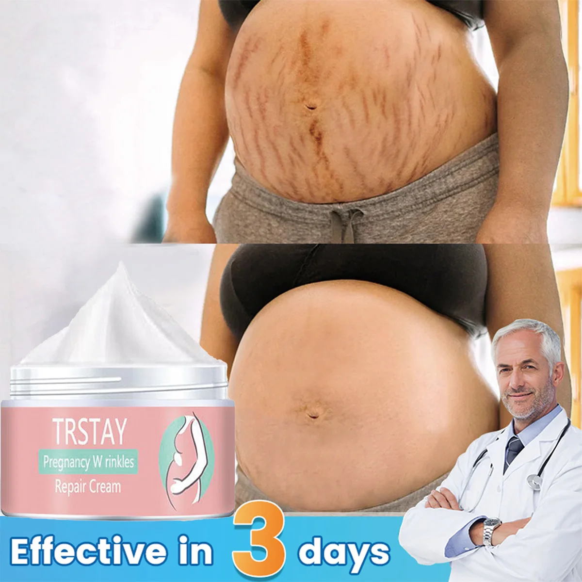 TRSTAY Repair Cream for Pregnancy Skin Care Elasticity Moisture Collagen Stretch Marks And Scars Fade during Maternity