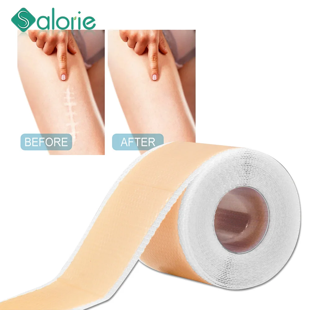 Silicone Scar Sheets Surgery Removal Gel Skin Repair Patch Self-Adhesive Stretch Mark Tape Burn Acne Scar Skin Care Sticker