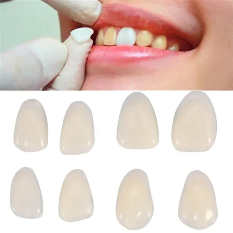 50Pcs/Bag Ultra Thin Resin Dental Veneers, Preformed Temporary Crowns for Upper Anterior Teeth, Whitening Shade, Dental Supplies