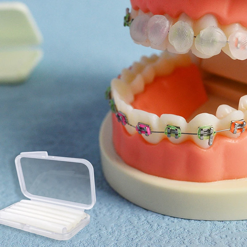 Orthodontie Dentaire, 5 Pièces/Boîte, Alerte Ortho, Mélange de Menthe, sexuellement pour Bretelles, Irritation Gomme, Blanchiment des Dents, Outils d'Hygiène Buccale