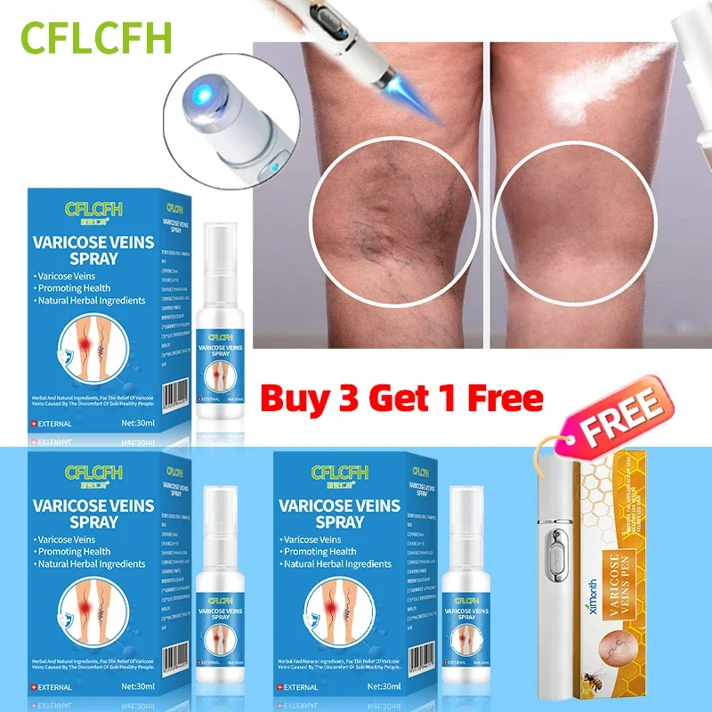 

3Pcs Varicose Veins Spray Relieve Legs Pain Varicose Vein Laser Therapy Pen Improve Blood Circulation For Men And Women Leg Care