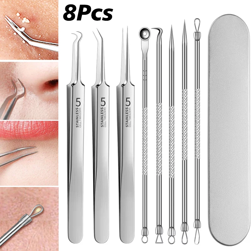 8/7/5/4 pezzi in acciaio inossidabile strumenti per la rimozione dei punti neri del viso set pinzette per punti neri bellezza rimozione dei punti neri strumento per l'ago dell'acne