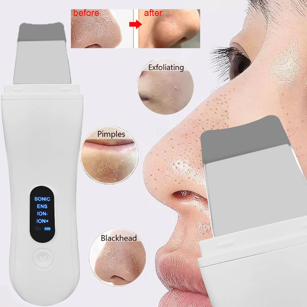 超音波スパチュラ美顔器　黒ずみ除去　ブラックドット洗顔　超音波スキンスクラバー　ディープフェイススパチュラピーリング