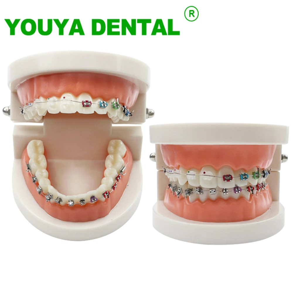 Orthodontic Teeth Model With Self Ligating Metal Bracket Ceramic Braces Typodont Demonstration Tools For Patient Communication