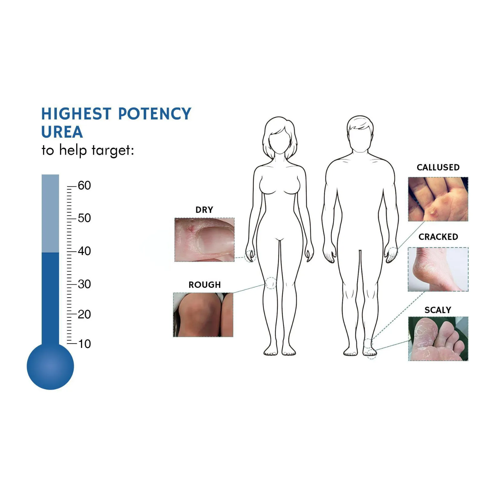 كريم اليوريا 42% كريم اليوريا لتجفيف وترطيب كريم اليدين والقدمين للبشرة الجافة، تقشير وتخفيف الحكة 100 جرام/زجاجة