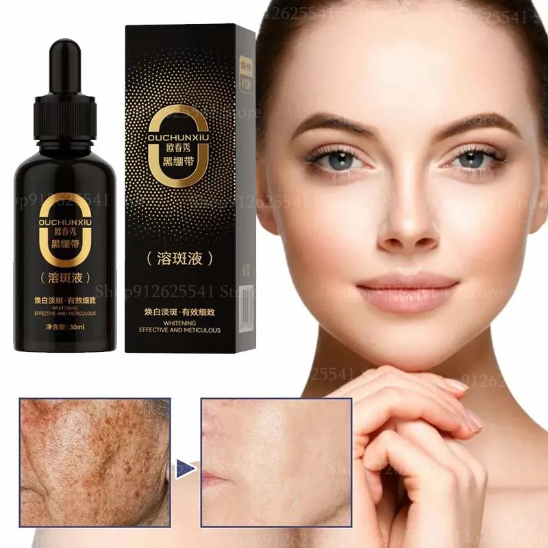 30ml Fade Pigmentation Melasma Brighten Skin Facial Essence Black Bandage Spot Dissolving Liquid Face Serum Whitening Skin Care