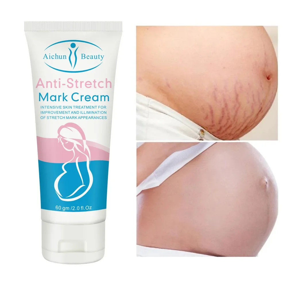 Moisturizing Eliminate stretch marks&growth marks Promotes skin regeneration Stretch mark cream Body Lotion Skincare