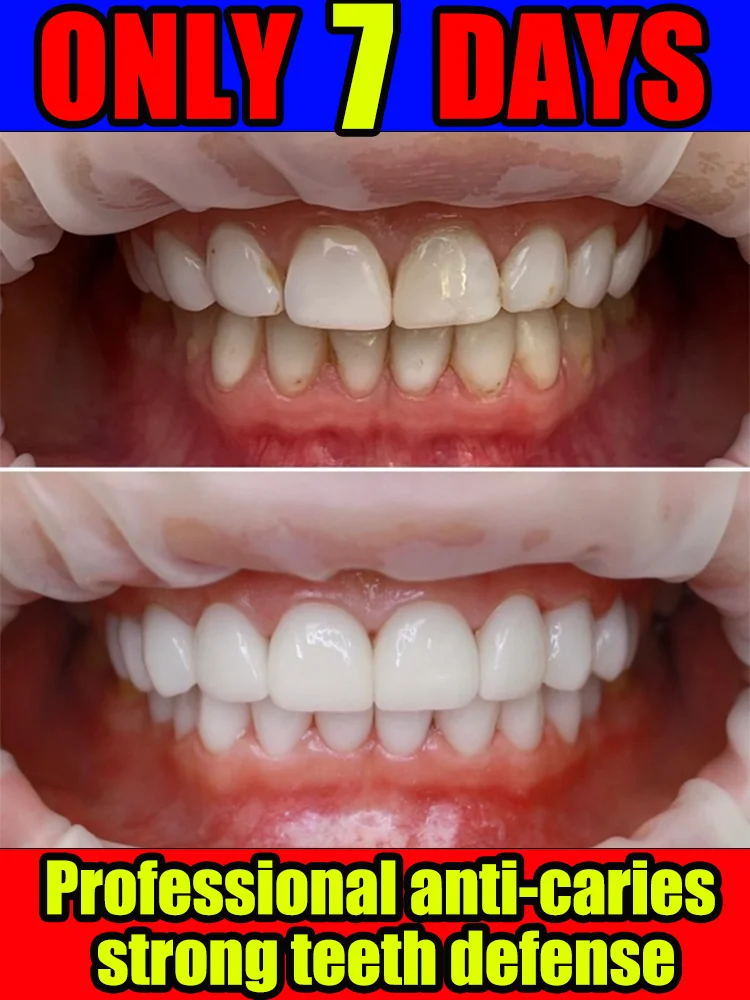 

Sᴇɴsɪᴛɪᴠᴇ Tᴇᴇᴛʜ Sᴀᴠɪᴏʀ - Aɴᴛɪ-Sᴇɴsɪᴛɪᴠᴇ Tᴏᴏᴛʜᴘᴀsᴛᴇ, Sᴏᴏᴛʜɪɴɢ Fᴏʀᴍᴜʟᴀ, Gᴜᴍ Pʀᴏᴛᴇᴄᴛɪᴏɴ, 30ɢ