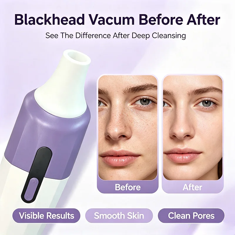 Visible Blackhead Remover Vacuum Electric Facial Pore Cleaner 2MP Camera Black Dot Suction Tool Skin Care Beauty Instrument