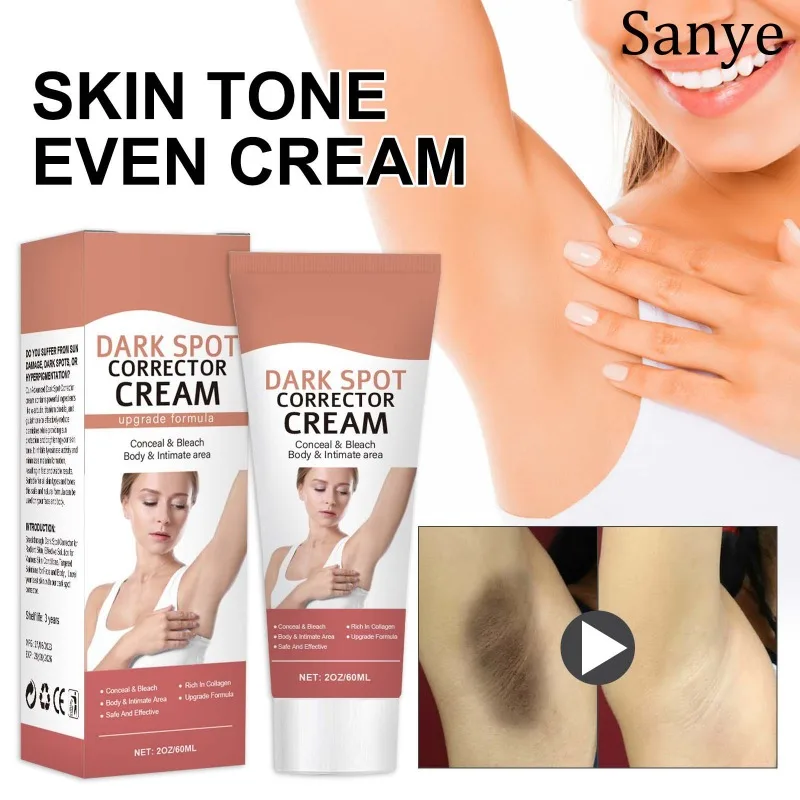 Body Buttocks Brightening Cream Fingers Intimate Areas Underarm Knee Bleaching Emulsion Remove Melanin Dark Skin Brighten Cream