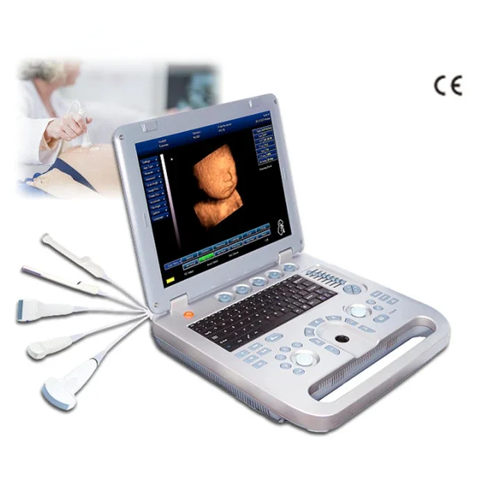 SUN-800D portable B/W USG laptop ultrasound machine price ultrasound scanner from Sunbright