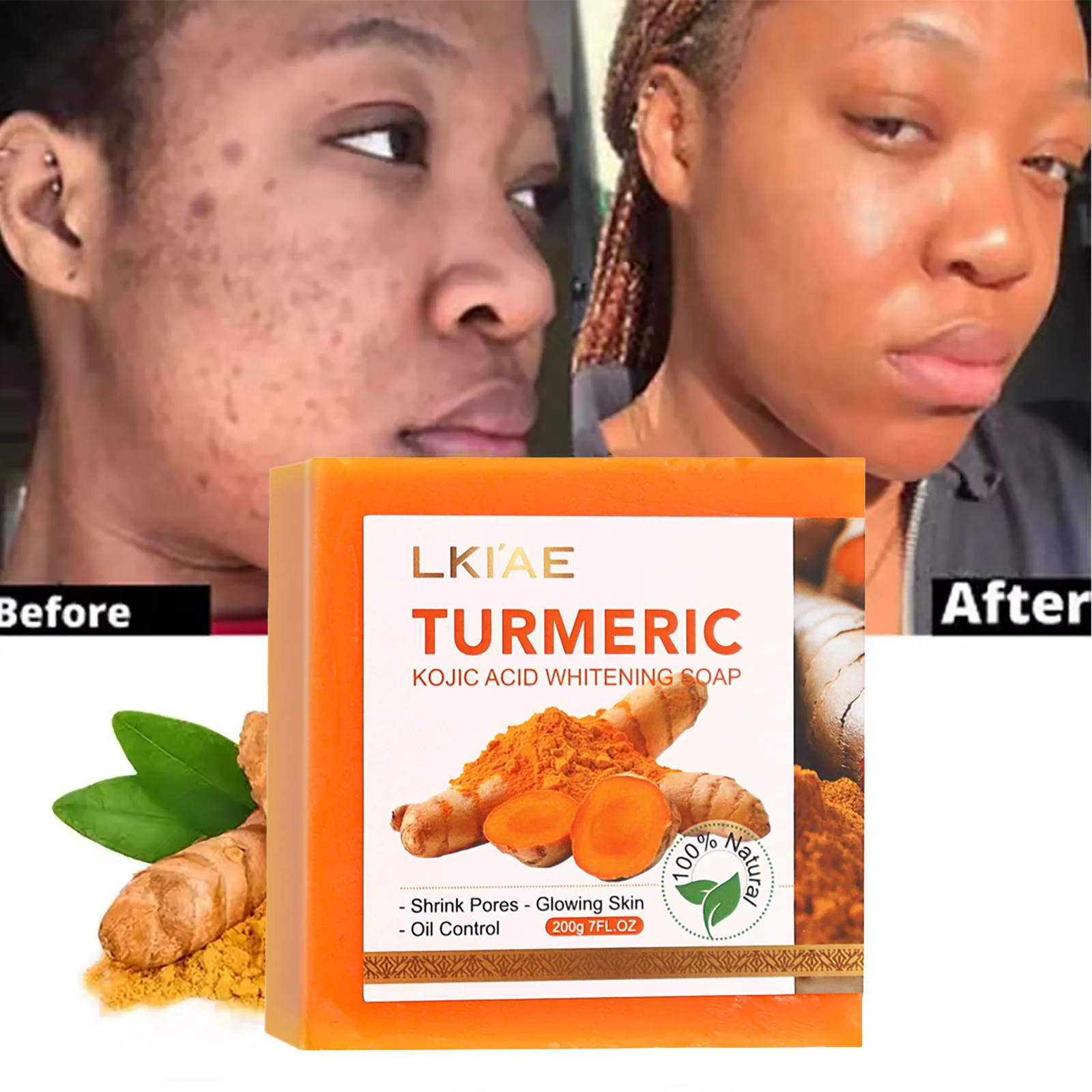 

LKIAE Organic Turmeric Soap Bar, Natural Herbal Hand Made Whitening Soap, Remove Melanin, Acne, Spots, For Face And Body,200g