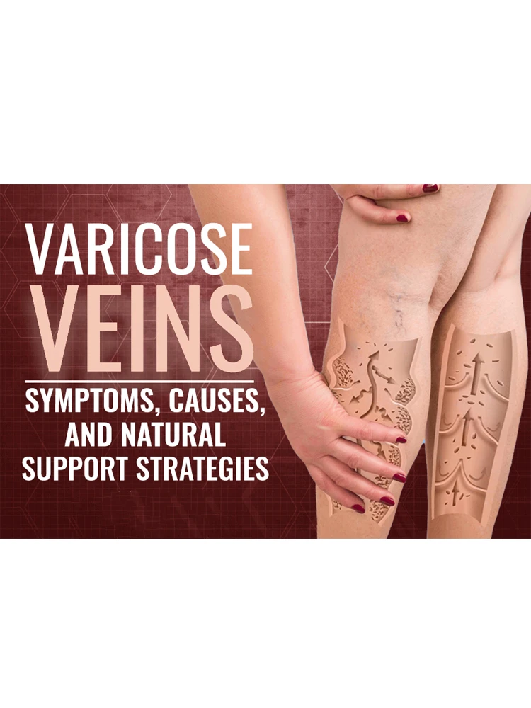 

30g Cream Crema para venas varicosas, Krampfader Creme, Crema para venas varicosas, Creme para varizes