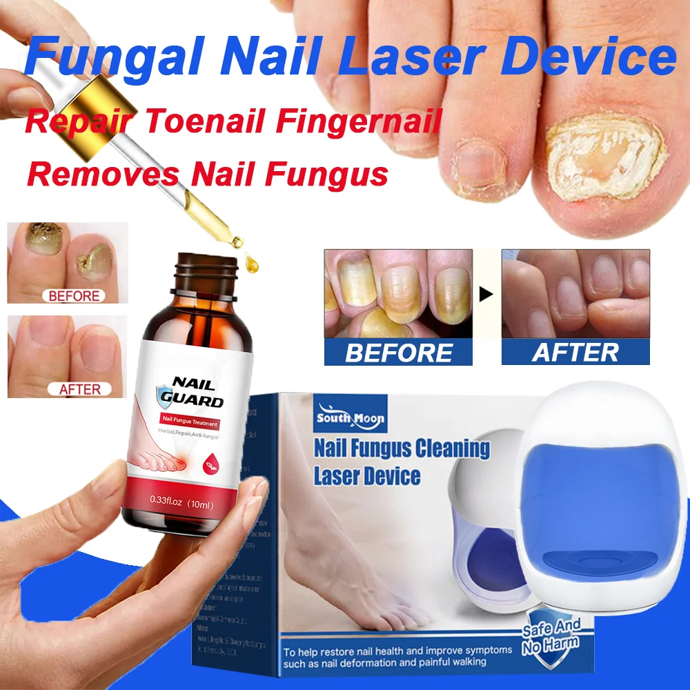 Fungal Nail Laser Device Repair Fast Nails Fungus Onychomycosis Repair Toenail Finger Nail Treat Removes Nail Fungus Foot Care