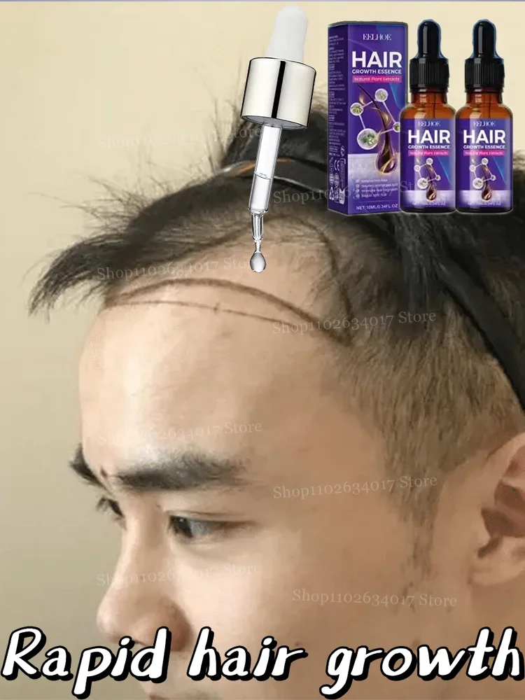 

Revitalize Your Scalp, Rejuvenate Your Hair Growth