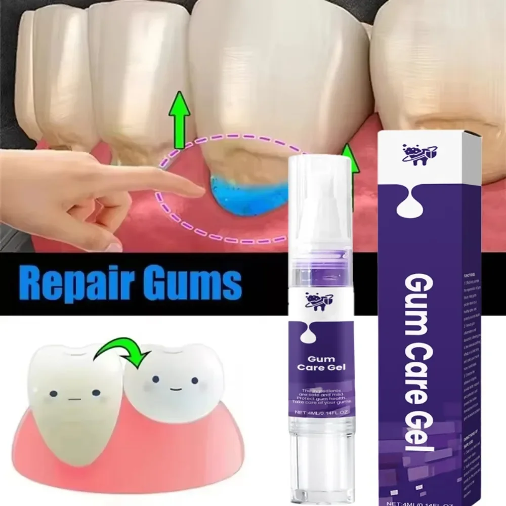 Gel para el cuidado de la reparación de las encías dañadas, alivia la alérgencia de las encías dolorosas, limpieza profunda de las manchas de dientes, suero de sarro, pasta de dientes para caries dentales