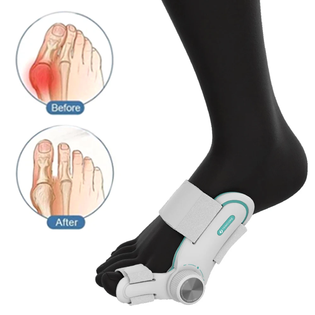 Bunion Corrector Big Toe Straightener Füße Schmerzlinderung Orthopädische Bunion Splint mit Big Toe Separatoren Verstellbare Bunion Splint