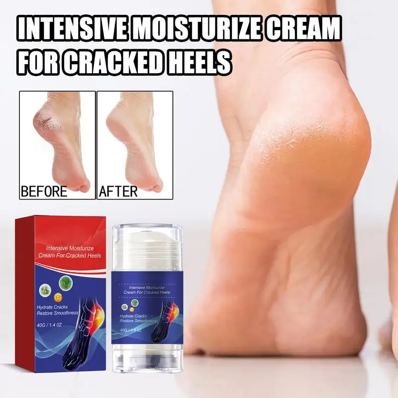 Crack Heel Cracking Repair Products, esfoliação, remoção de pele morta, amolecimento, hidratação, mão, cuidados com os pés, 40g, 1pc