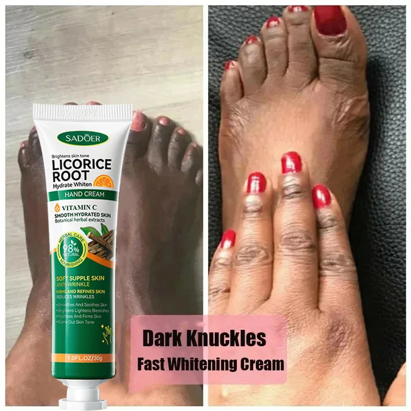 Fast Whitening Dark Knuckles Brighten Hand Cream Melanin Corrector Moisturizing Intense Stains Remover Products Skin Care