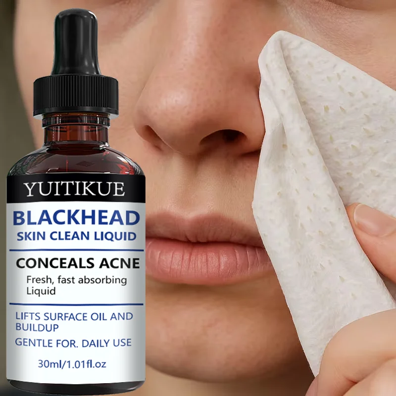 YUITIKUE Blackhead Remover Liquid Gentle Acne Oil Control Deep Cleansing Pore Refining Skin Care