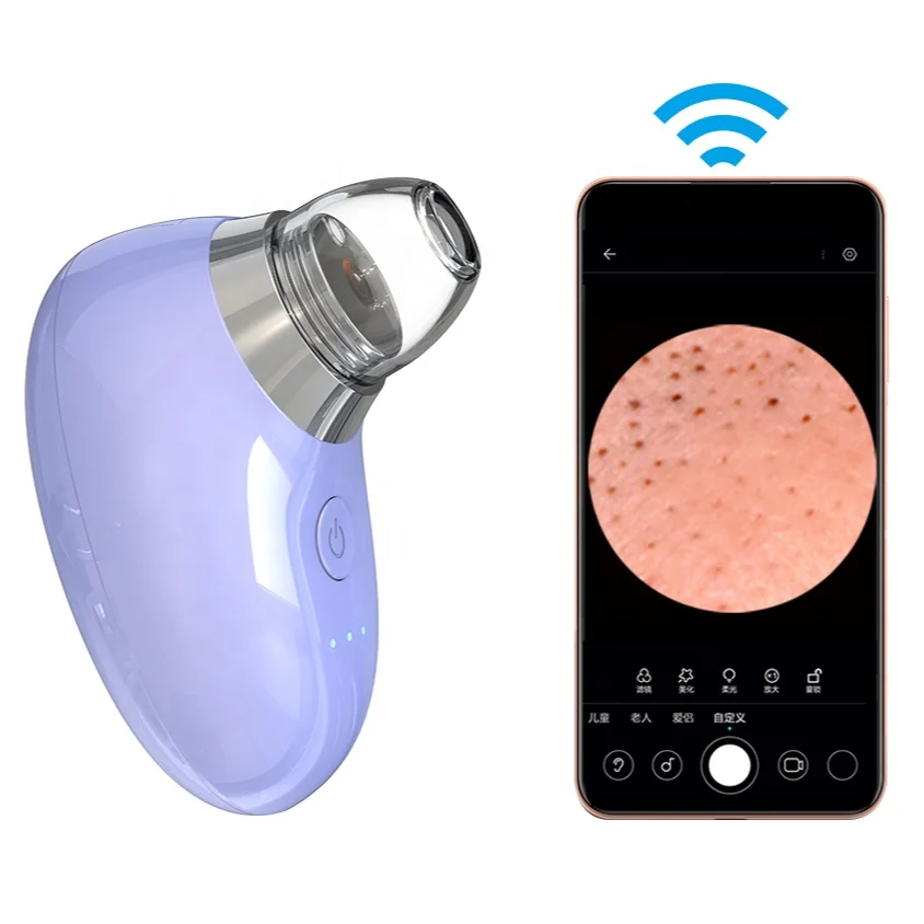 Electric Pore Cleaner Cute 30x HD Visual APP Connect Vacuum Blackhead Remover Camera