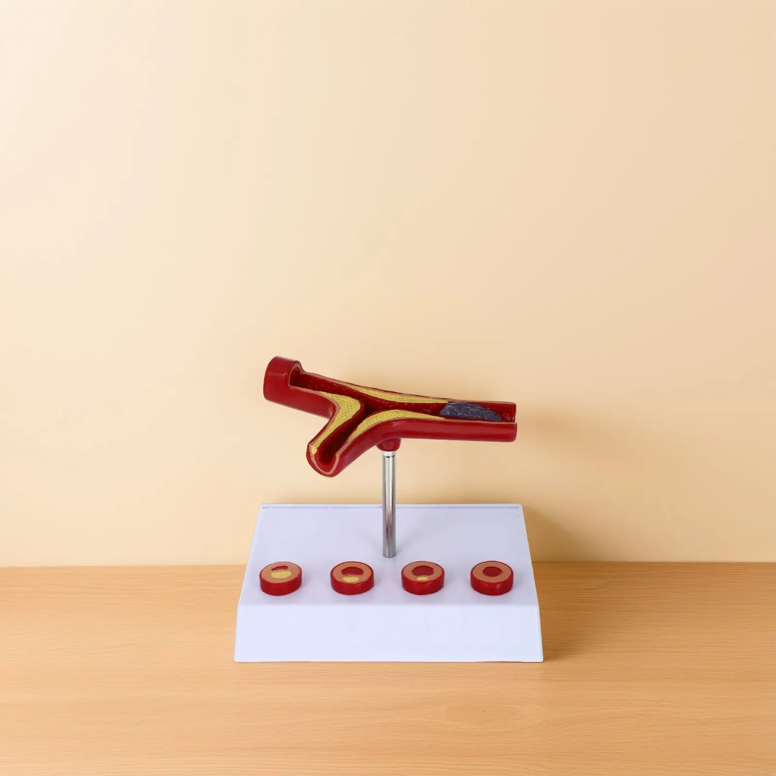 

Учебный демонстрационный макет анатомии сердечно-сосудистой атеросклерозной болезни из ПВХ: кровеносные сосуды человека для больниц и медицинских учебных заведений