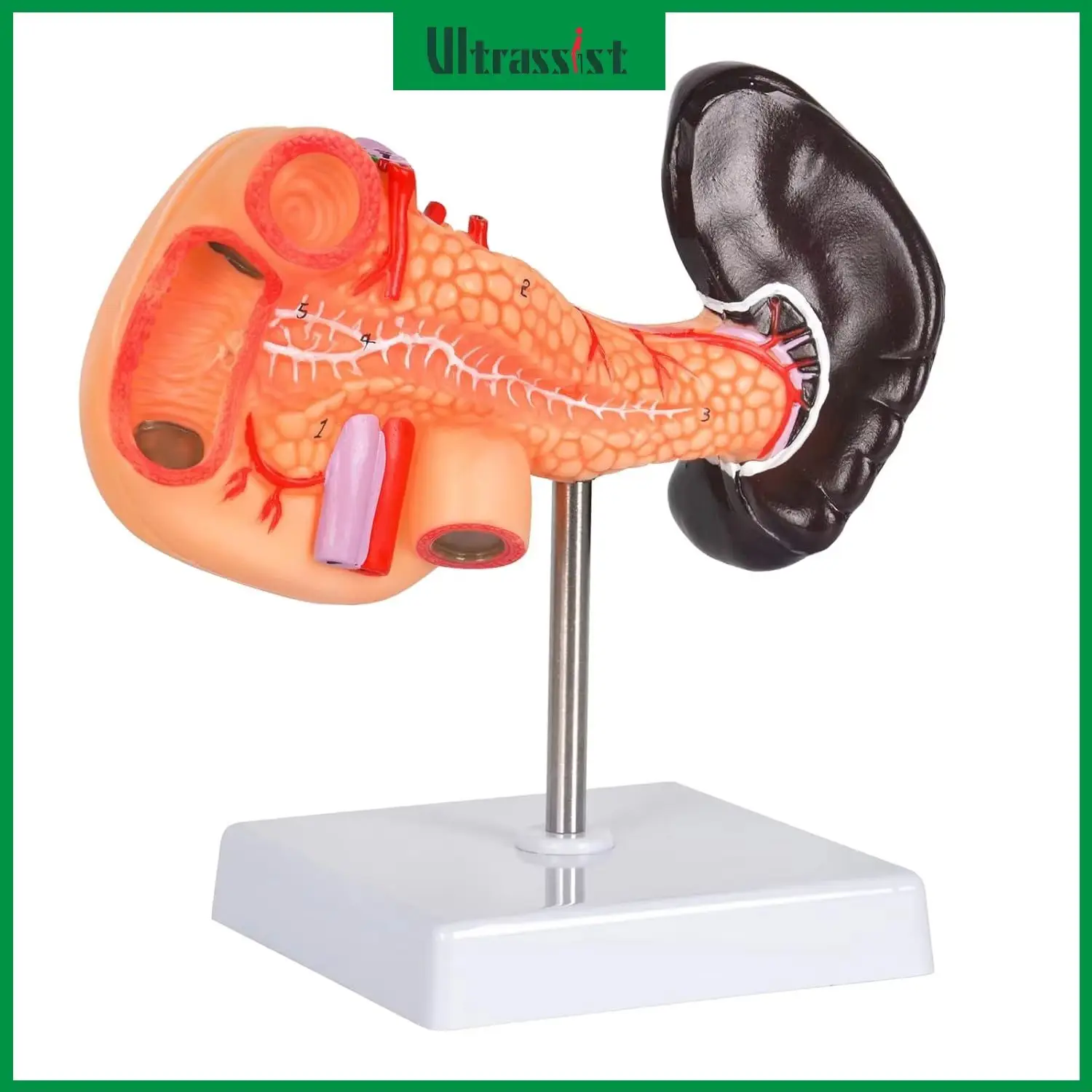 Ultrassist Human Pancreas & Spleen Anatomy Model Normal Structure Anatomical Assisted Dissection for Medical Student Education