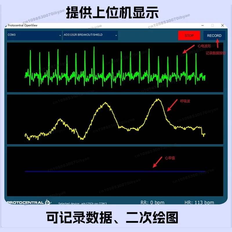 For ADS1292 Digital ECG Module ECG Front End, Respiratory Heart Rate Impedance Acquisition, Microcontroller Development Kit