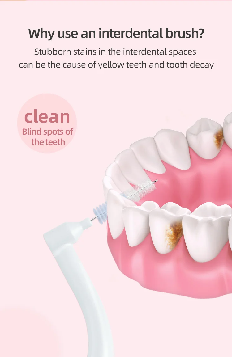 Super Deer 0,7-mm-L-förmiger Interdentalbürste mit weichen Borsten, Interdental-Zahnbürsten zur Reinigung zwischen den Zähnen, geeignet für Zahnspangen. – Detail 4
