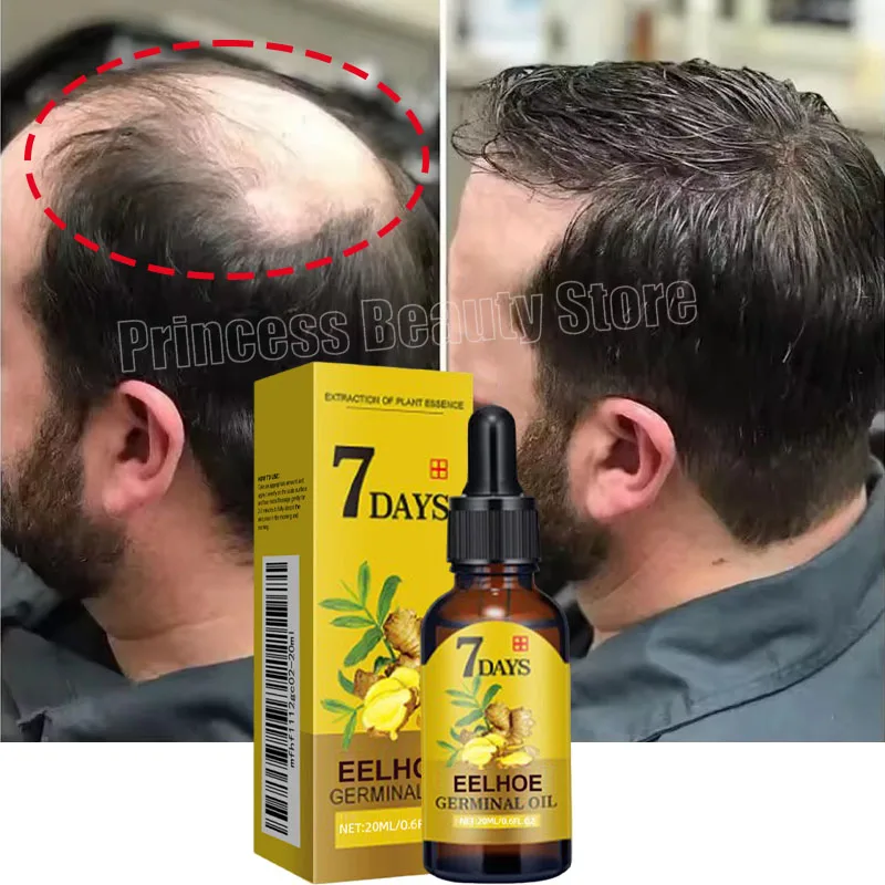 

7 Day Rapid Growth Liquid Anti Hair Loss Ginger Growth Conditioning Treatment Nourish Hair Growth Oil Scalp Care Serum Products