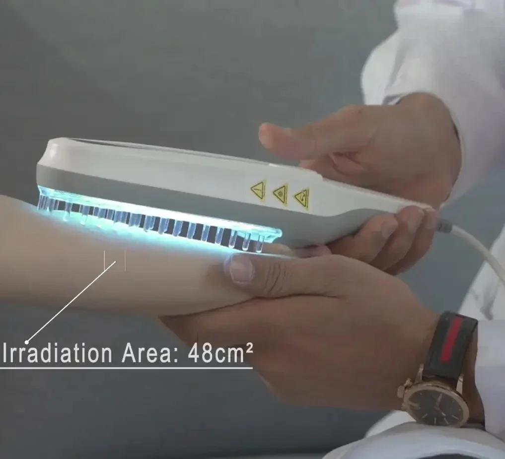CE Timer function narrow band uvb light therapy 311 nm uvb lamp for vitiligo phototherapy for atopic dermatitis