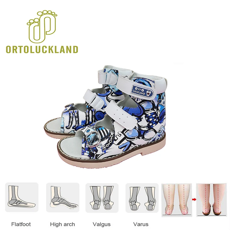 Summer Children Sandals Orthopedic Shoes For Kids Boys Printed Buckle Strap Arch Support Flatfoot Footwear Size22 To32