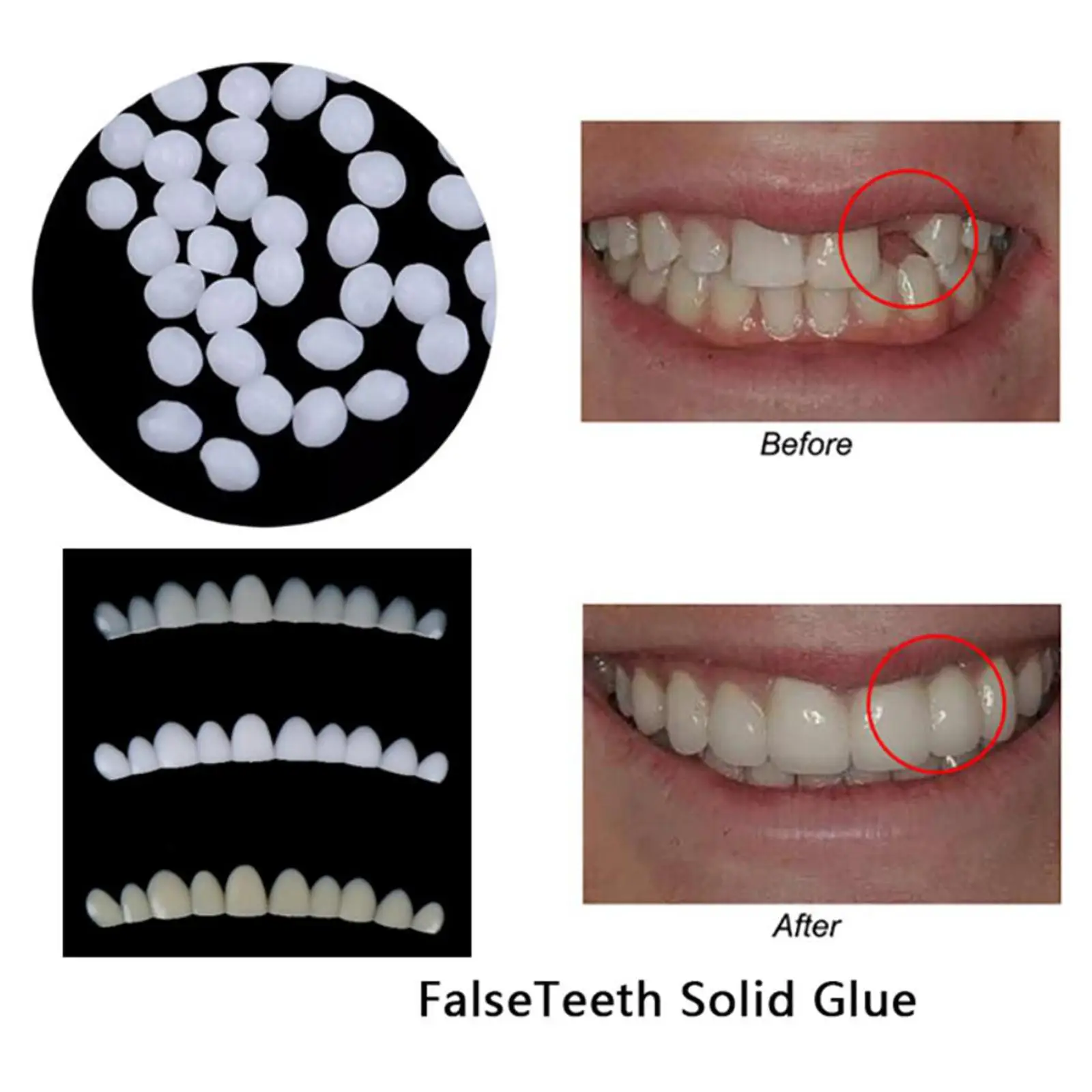 Resin Fake Teeth Snap in Veneers Kit Adjustable False Teeth Dental Whitening Cosmetic Installation for Dentures and DIY Projects