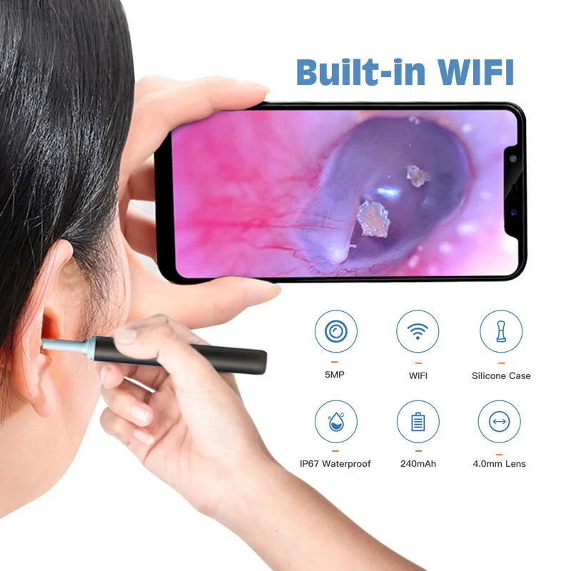 Xiaomi อุปกรณ์แคะหูไร้สาย Wi-Fi พร้อมกล้องเอ็นโดสโคปหูฟังเรืองแสงสำหรับทำความสะอาดและขจัดตะกรันดูแลส่วนบุคคล