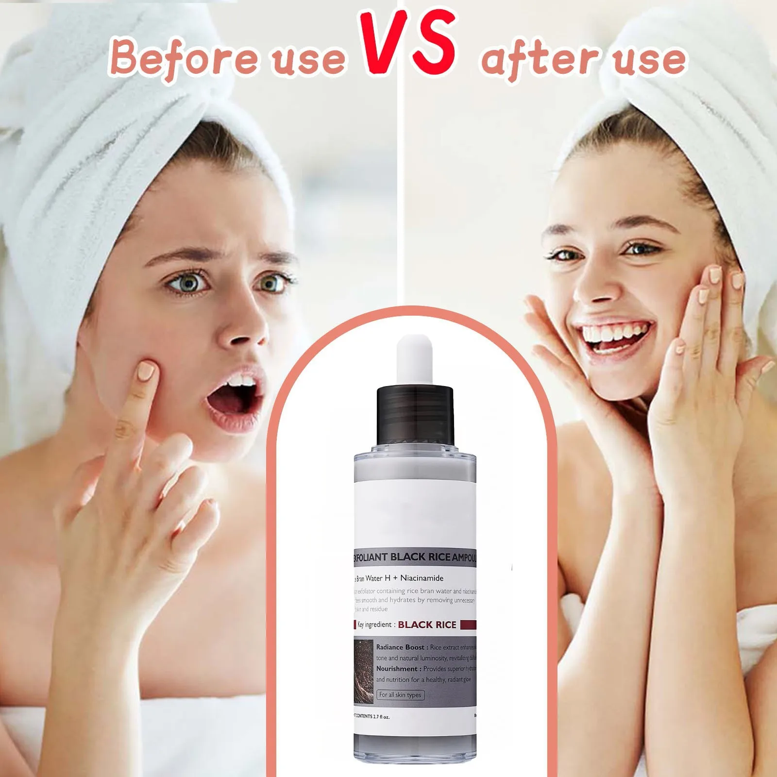

4-in-1 Black Rice Exfoliator Gentle Exfoliator For Face And Body To Remove Dead Skin Cells And Blackheads Exfoliating Pore Care