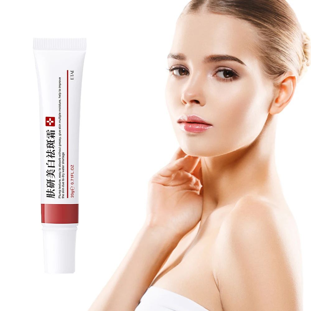 Crema blanqueadora para pecas, crema para eliminar manchas oscuras, antienvejecimiento, pigmentación, Melasma, ilumina la piel, 20g