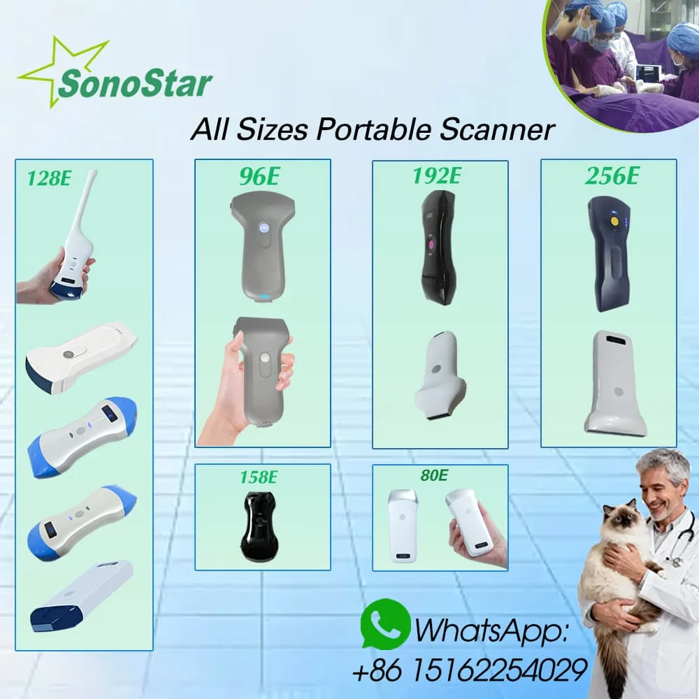 Sonostar Wireless Ultrasound Probe Scanner Portable Machine WIFI Ultrasound Scanner Machine for human /veterinary use