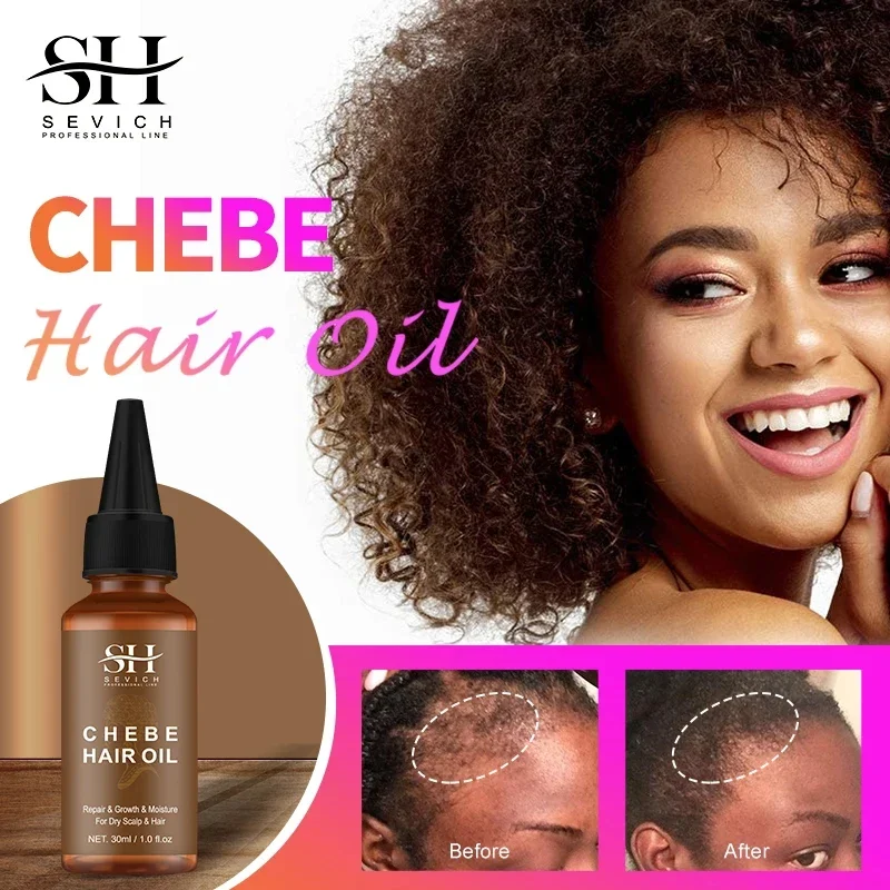 Aceite Chebe para el crecimiento del cabello, tratamiento anticaída de cabello, productos de crecimiento rápido, reparación de daños, cuidado del cabello seco, aceites esenciales para hombres y mujeres