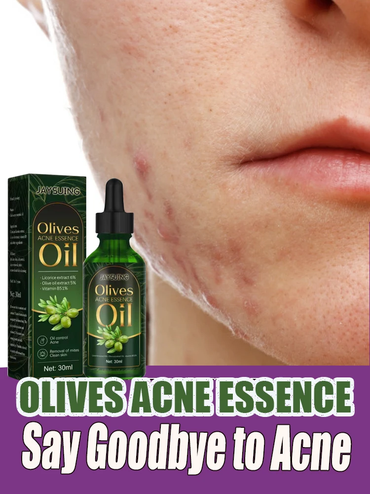 

Skin Care Moisturizing Oil Acne Removal Serum Shrink Pores Oil-Control Brighten Serum,Diminish Acne, Repair Redness