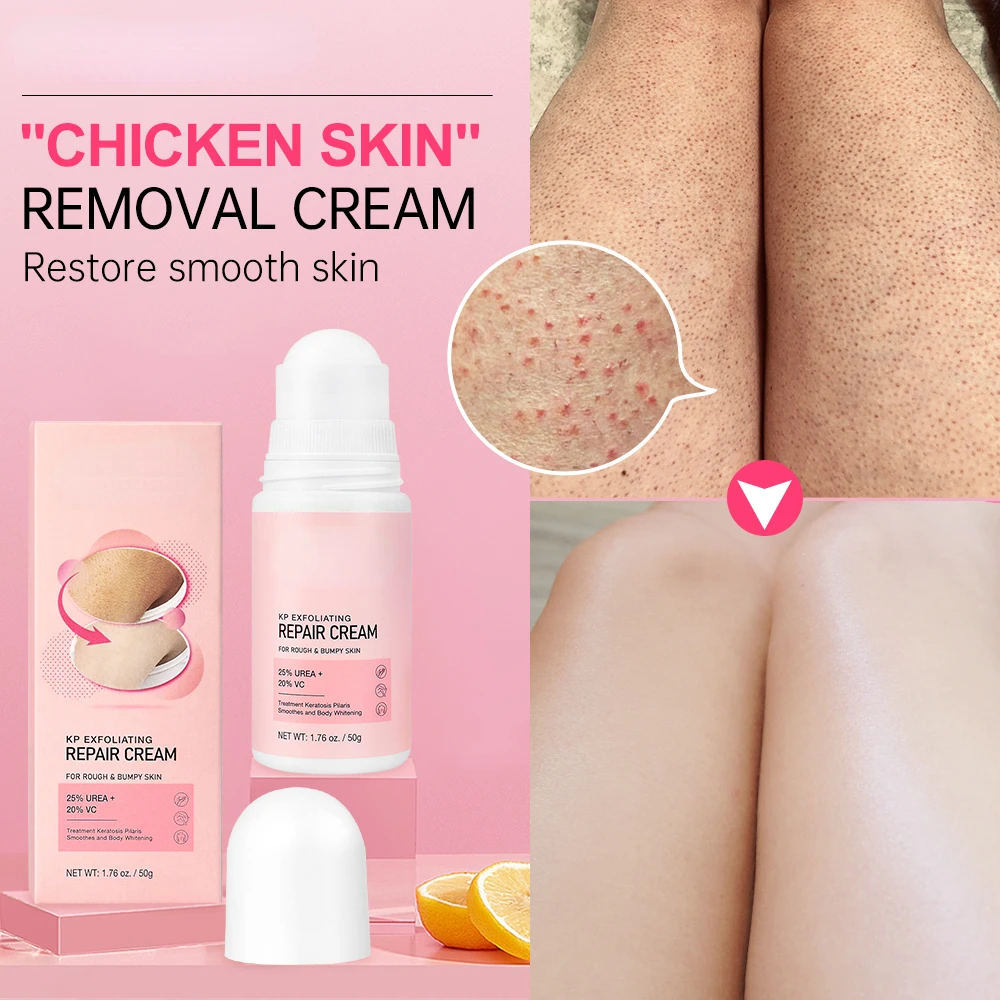 Vitamin C Whitening Cream Chicken Skin Treatment Lotion Keratosis Follicle Pilaris Curing Bumpy Pore Spot Smoothing Body Care