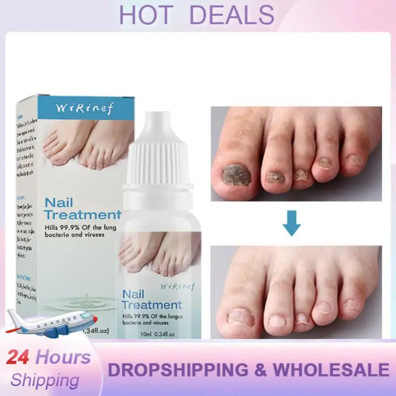 Onychomycosis Gel Visible Results Clinically Proven Powerful Bestselling Premium Top Rated Toenail Fungus Remover For Women