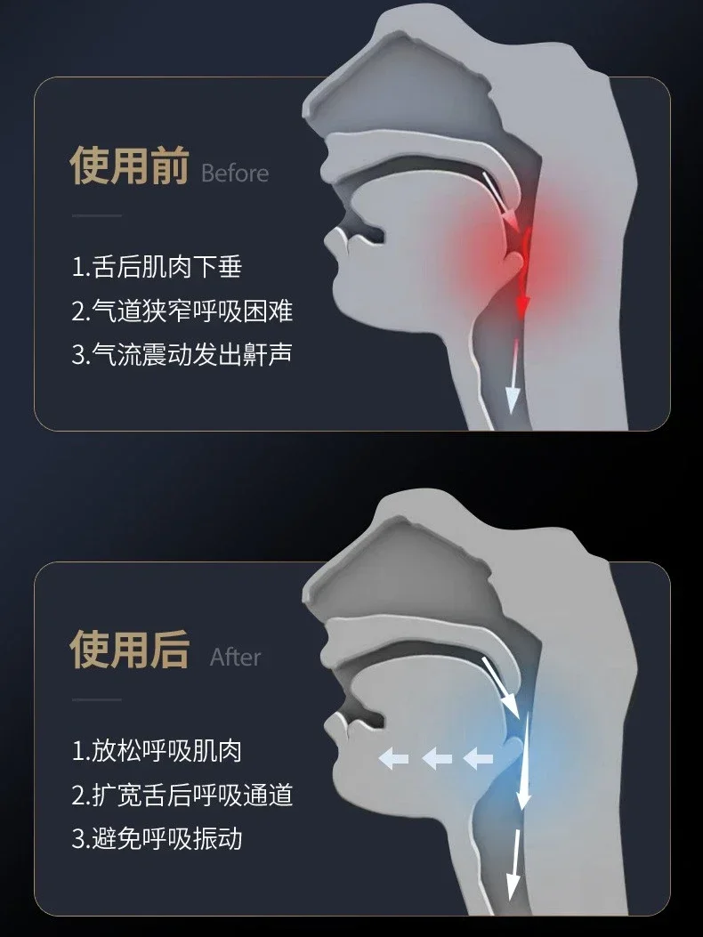 Improvement and correction of intelligent electric snore stopper to prevent ventilator portable man from sleeping