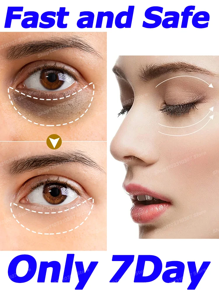 Eye Cream Eyes Bags Wrinkle Dark Circle