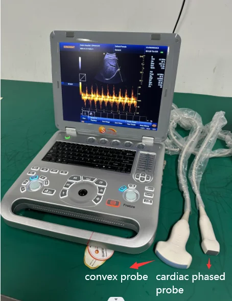 High quality ultrasound portatil veterinary ultrasound machine for hospital 4D vascular doppler echography ultrasound scanner