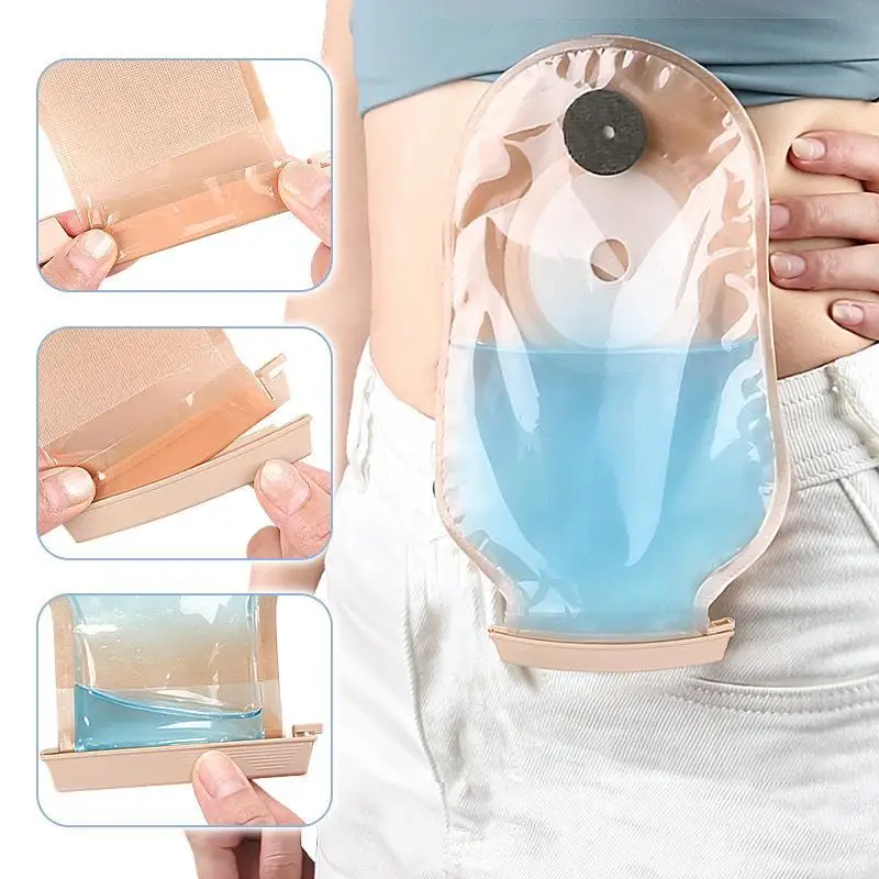 Ostomy Bag Clip Drainable Pouch Clamp Tail Closure Leak- Proof Colostomy Sealing Bar Postoperative Care Tool Fistula Accessories